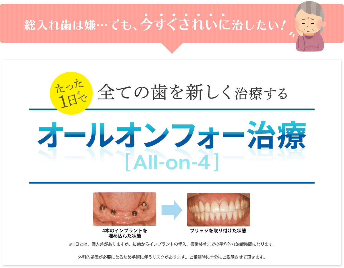 たった1日で全ての歯を新しく治療するオールオンフォー治療[All-on4]