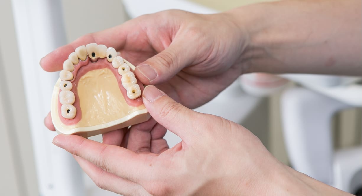 患者様に負担の無いインプラント治療をご提供できます