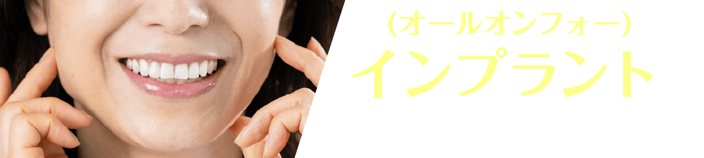 (オールオンフォー)インプラントでこんなに綺麗な口元に!